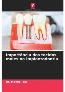 Importância dos tecidos moles na implantodontia