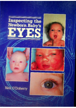 Inspecting the Newborn Baby's Eyes