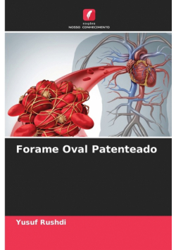 Forame Oval Patenteado