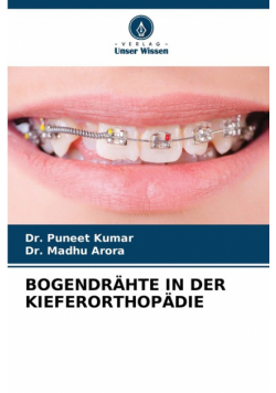 Bogendrähte In Der Kieferorthopädie