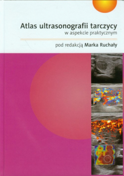 Atlas ultrasonografii tarczycy w aspekcie praktycznym