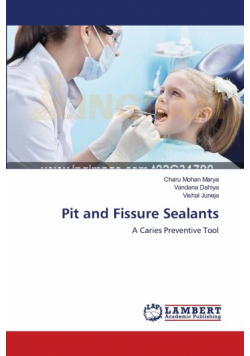Pit and Fissure Sealants