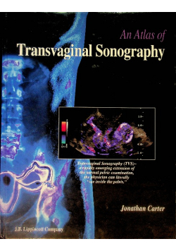 An Atlas Of Transvaginal Sonography