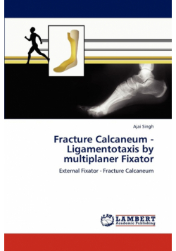 Fracture Calcaneum - Ligamentotaxis by multiplaner Fixator