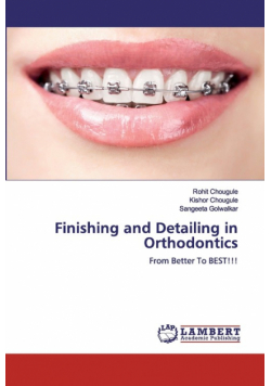 Finishing and Detailing in Orthodontics