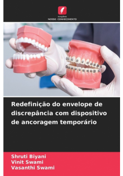Redefinição do envelope de discrepância com dispositivo de ancoragem temporário