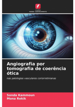 Angiografia por tomografia de coerência ótica