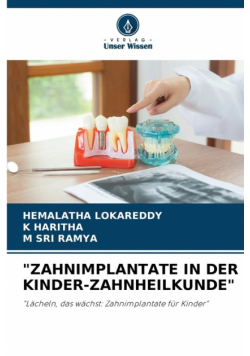 "zahnimplantate In Der Kinder-Zahnheilkunde"