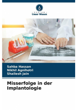 Misserfolge in der Implantologie