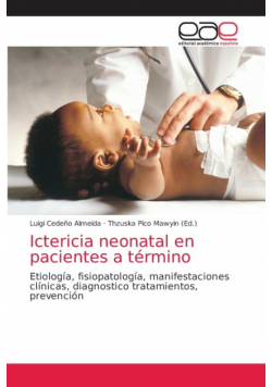 Ictericia neonatal en pacientes a término
