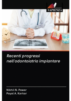 Recenti progressi nell'odontoiatria implantare