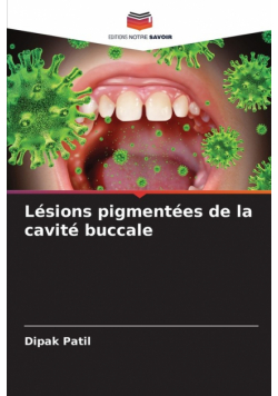 Lésions pigmentées de la cavité buccale