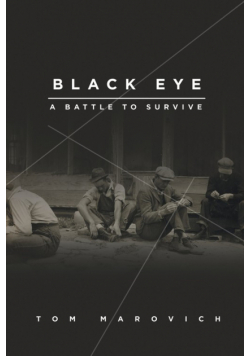 Black Eye