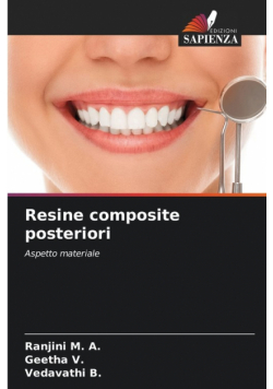 Resine composite posteriori
