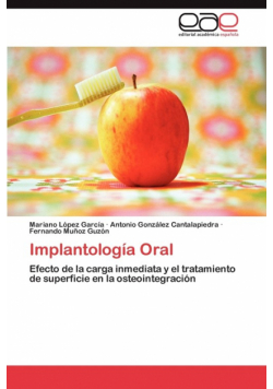 Implantología Oral