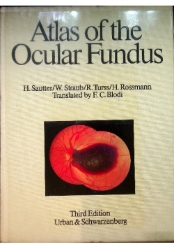 Atlas of the ocular fundus: Photographs of typical changes in ocular and systemic disease