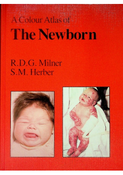 A Colour Atlas Of The Newborn