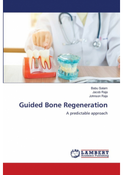 Guided Bone Regeneration