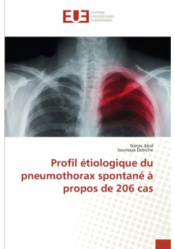 Profil étiologique du pneumothorax spontané à propos de 206 cas