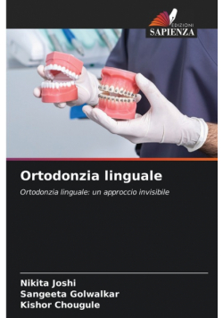 Ortodonzia linguale