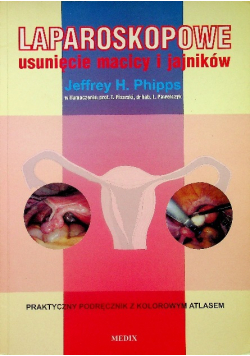 Laparoskopowe usunięcie macicy i jajników