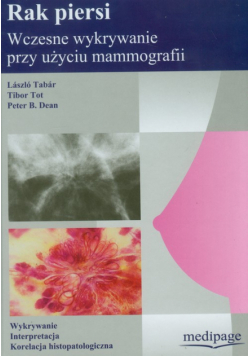 Dean Peter B. - Rak piersi wczesne wykrywanie przy użyciu mammografii