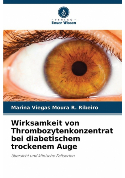 Wirksamkeit von Thrombozytenkonzentrat bei diabetischem trockenem Auge