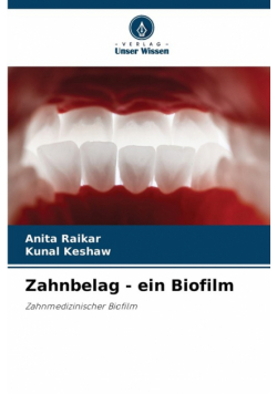 Zahnbelag - ein Biofilm