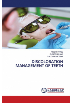 Discoloration Management Of Teeth