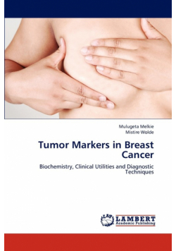 Tumor Markers in Breast Cancer