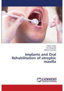Implants and Oral Rehabilitation of atrophic maxilla