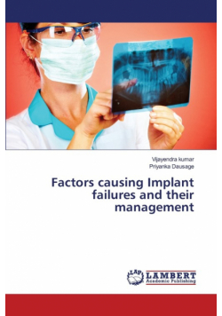 Factors causing Implant failures and their management