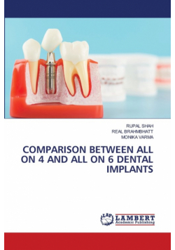Comparison Between All On 4 And All On 6 Dental Implants