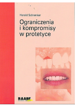 Ograniczenia i kompromisy w protetyce