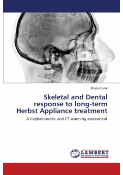 Skeletal and Dental response to long-term Herbst Appliance treatment