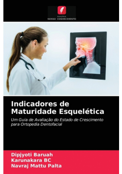 Indicadores de Maturidade Esquelética