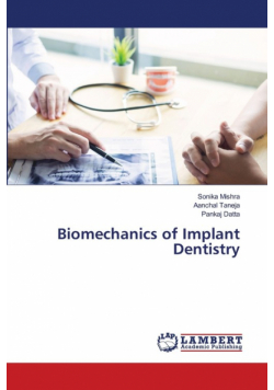 Biomechanics of Implant Dentistry