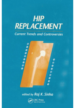 Hip Replacement