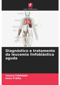 Diagnóstico e tratamento da leucemia linfoblástica aguda