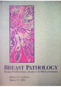 Breast Pathology: Benign Proliferations Atypias and in Situ Carcinomas