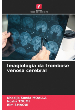 Imagiologia da trombose venosa cerebral