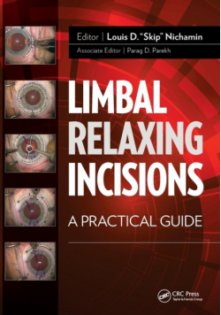 Limbal Relaxing Incisions