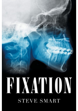 Fixation