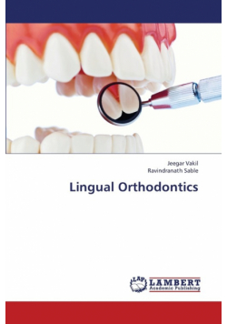 Lingual Orthodontics