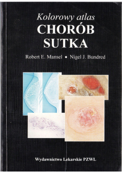 Kolorowy atlas chorób sutków