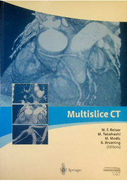 Multislice CT