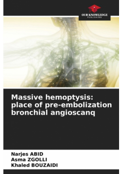 Massive hemoptysis