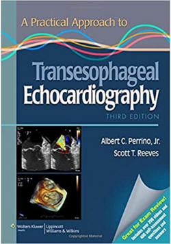 Transesophageal Echocardiography