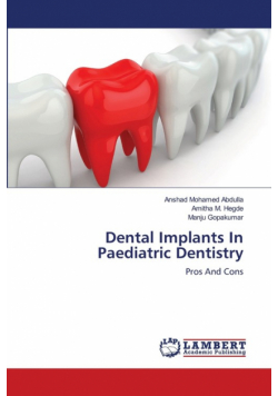Dental Implants In Paediatric Dentistry