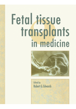 Fetal Tissue Transplants in Medicine